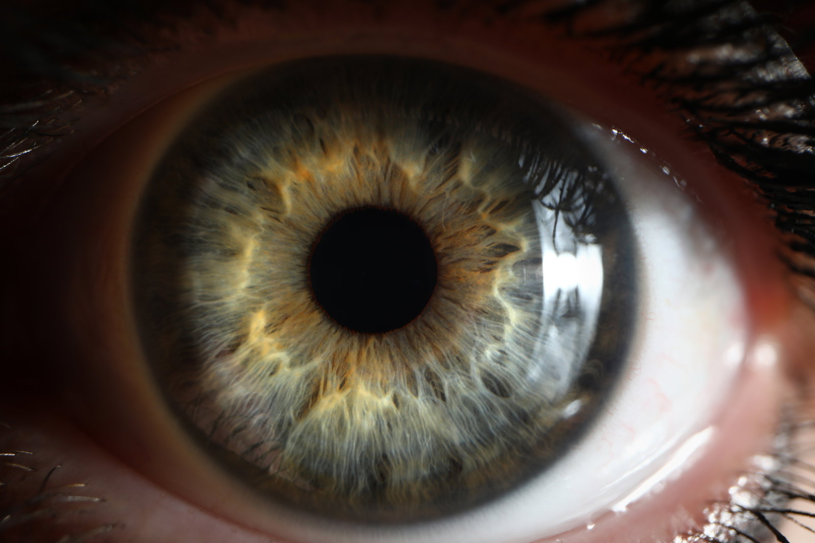 The Iris Codes: Unlocking the Hidden Connection Between Your Eye, Your Health, and Your Personality